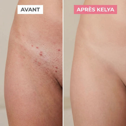 La solution douce pour toutes les zones sensibles